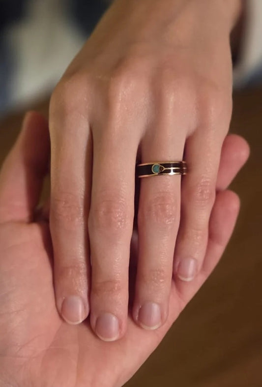 Hypoallergenic Wedding Bands: Why the Metal You Choose Really Matters